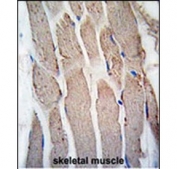 IHC staining of FFPE human skeletal muscle tissue with GREM1 antibody. HIER: steam section in pH6 citrate buffer for 20 min and allow to cool prior to staining.