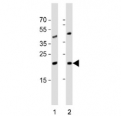 Western blot testing of 1) human Jurkat and 2) mouse testis tissue lysate with ORMDL3 antibody. Predicted molecular weight ~17 kDa.