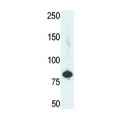 Western blot testing of human HepG2 cell lysate with PFKL antibody. Predicted molecular weight ~85 kDa.