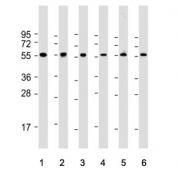 Western blot testing of human 1) HeLa, 2) K562, 3) HEK293, 4) testis, 5) brain and 6) kidney tissue lysate with MAPE antibody. Predicted molecular weight ~58 kDa.