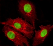 Immunofluorescent staining of fixed and permeabilized human HepG2 cells with FOXD1 antibody (green) and Phalloidin (red).