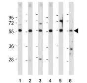 Western blot testing of 1) human HEK293, 2) human U-2 OS, 3) human U-87 MG, 4) human Y79, 5) mouse kidney and 6) mouse eyeball tissue lysate with FOXD1 antibody. Predicted molecular weight ~46 kDa.