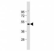 Western blot testing of HUVEC lysate with B2AR antibody. Predicted molecular weight ~46 kDa.