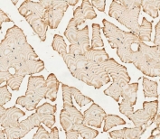 IHC staining of FFPE human skeletal muscle tissue with PFKFB4 antibody. HIER: steam section in pH6 citrate buffer for 20 min and allow to cool prior to staining.