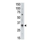 Western blot testing of human Jurkat cell lysate with MAGE3 antibody. Predicted molecular weight ~35 kDa.
