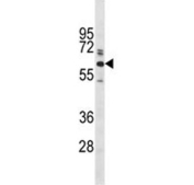 Western blot testing of human HeLa cell lysate with Glypican-1 antibody. Predicted molecular weight ~62 kDa.