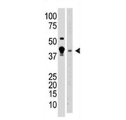 Western blot testing of 1) human A375 and 2) mouse brain tissue lysate with MBD2 antibody. Expected molecular weight ~47 kDa.