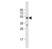 Western blot testing of human K562 cell lysate with MBD2 antibody. Expected molecular weight ~47 kDa.
