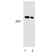 Western blot testing of human 1) HepG2 and 2) A549 cell lysate with PIEZO2 antibody. Expected molecular weight ~318 kDa.