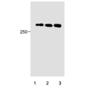 Western blot testing of human 1) HeLa, 2) HepG2 and 3) A549 cell lysate with PIEZO2 antibody. Expected molecular weight ~318 kDa.