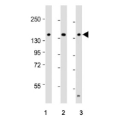 Western blot testing of human 1) Ramos, 2) HCT-116 and 3) RPM1 8226 cell lysate with TIAM1 antibody. Expected molecular weight ~178 kDa.