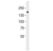 Western blot testing of human brain tissue lysate with KCNT1 antibody. Predicted molecular weight: 137-142 kDa (multiple isoforms) and may be observed at higher molecular weights due to glycosylation.