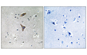 IHC staining of FFPE human brain tissue with KCNT1 antibody (left) and negative control (right). HIER: steam section in pH6 citrate buffer for 20 min and allow to cool prior to staining.
