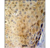 IHC staining of FFPE human skin tissue with GSDMA antibody. HIER: steam section in pH6 citrate buffer for 20 min and allow to cool prior to staining.