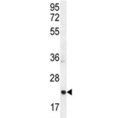 Western blot testing of mouse bladder tissue lysate with ASCL2 antibody. Predicted molecular weight ~20 kDa.