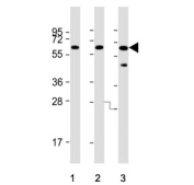 Western blot testing of human 1) HL60, 2) U-87 MG and 3) K562 cell lysate with IL1RL2 antibody. Predicted molecular weight ~65 kDa.