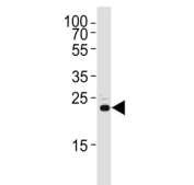 Western blot testing of human HEK293 cell lysate with RSPO2 antibody. Predicted molecular weight ~28 kDa, ~20 kDa and ~21 kDa (three isoforms).