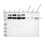 Western blot analysis of ROR2 using anti-ROR2 antibody. Lane 1: human Hela whole cell lysates, Lane 2: human K562 whole cell lysates, Lane 3: human SH-SY5Y whole cell lysates, Lane 4: human 293T whole cell lysates, Lane 5: rat small intestine tissue lysates, Lane 6: rat ovary tissue lysates, Lane 8: mouse small intestine tissue lysates. After electrophoresis, proteins were transferred to a nitrocellulose membrane at 150 mA for 50-90 minutes. Blocked the membrane with 5% non-fat milk/TBS for 1.5 hour at RT. The membrane was incubated with rabbit anti-ROR2 antibody at 0.5 ug/ml overnight at 4oC, then washed with TBS-0.1%Tween 3 times with 5 minutes each and probed with a goat anti-rabbit IgG-HRP secondary antibody at a dilution of 1:5000 for 1.5 hour at RT. The signal was developed using enhanced chemiluminescent. The expected band size for ROR2 is at 105 kDa but may be observed at higher molecular weights due to glycosylation.
