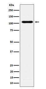 Western blot analysis of EXOC2 expression in BxPC-3 cell lysate. Predicted molecular weight ~104 kDa.