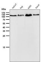 All lanes use the antibody at 1:3K dilution for 1 hour at room temperature. Predicted molecular weight ~104 kDa.