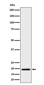 Western blot analysis of BCL2L15 in His-tagged BCL2L15 cell lysate. Predicted molecular weight ~18 kDa.