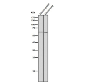 All lanes use the antibody at 1:3K dilution for 1 hour at room temperature. Predicted molecular weight ~66 kDa.