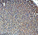 IHC analysis of GHRHR using anti-GHRHR antibody. GHRHR was detected in a paraffin-embedded section of mouse adrenal tissue. Heat mediated antigen retrieval was performed in EDTA buffer (pH 8.0, epitope retrieval solution). The tissue section was blocked with 10% goat serum. The tissue section was then incubated with 2 ug/ml rabbit anti-GHRHR antibody overnight at 4oC. Peroxidase Conjugated Goat Anti-rabbit IgG was used as secondary antibody and incubated for 30 minutes at 37oC. The tissue section was developed using an HRP secondary and DAB substrate.