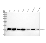Western blot analysis of Histone H3 using anti-Histone H3 (acetyl K14) antibody. Electrophoresis was performed on a 12% SDS-PAGE gel at 80V (Stacking gel) / 120V (Resolving gel) for 2 hours. Lane 1: human 293T whole cell lysates, Lane 2: human U2OS whole cell lysates, Lane 3: human whole cell lysates, Lane 4: human HepG2 whole cell lysates, Lane 5: rat heart tissue lysates, Lane 6: mouse brain tissue lysates, Lane 7: mouse heart tissue lysates. After electrophoresis, proteins were transferred to a nitrocellulose membrane at 150 mA for 50-90 minutes. Blocked the membrane with 5% non-fat milk/TBS for 1.5 hour at RT. The membrane was incubated with rabbit anti-Histone H3 (acetyl K14) antibody at a dilution of 1:500 overnight at 4oC, then washed with TBS-0.1%Tween 3 times with 5 minutes each and probed with a goat anti-rabbit IgG-HRP secondary antibody at a dilution of 1:5000 for 1.5 hour at RT. The signal was developed using an ECL Plus Western Blotting Substrate. The expected band size for Histone H3 (acetyl K14) is at 15 kDa.