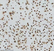 IHC analysis of Histone H3 (acetyl K14) using anti-Histone H3 (acetyl K14) antibody. Histone H3 (acetyl K14) was detected in a paraffin-embedded section of mouse brain tissue. Heat mediated antigen retrieval was performed in EDTA buffer (pH 8.0, epitope retrieval solution). The tissue section was blocked with 10% goat serum. The tissue section was then incubated with a dilution of 1:50 rabbit anti-Histone H3 (acetyl K14) antibody overnight at 4oC. Peroxidase Conjugated Goat Anti-rabbit IgG was used as secondary antibody and incubated for 30 minutes at 37oC. The tissue section was developed using an HRP secondary and DAB substrate.