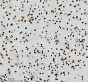 IHC analysis of Histone H3 (acetyl K14) using anti-Histone H3 (acetyl K14) antibody. Histone H3 (acetyl K14) was detected in a paraffin-embedded section of rat brain tissue. Heat mediated antigen retrieval was performed in EDTA buffer (pH 8.0, epitope retrieval solution). The tissue section was blocked with 10% goat serum. The tissue section was then incubated with a dilution of 1:50 rabbit anti-Histone H3 (acetyl K14) antibody overnight at 4oC. Peroxidase Conjugated Goat Anti-rabbit IgG was used as secondary antibody and incubated for 30 minutes at 37oC. The tissue section was developed using an HRP secondary and DAB substrate.