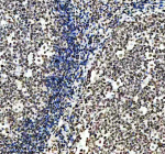 IHC analysis of Histone H3 (acetyl K14) using anti-Histone H3 (acetyl K14) antibody. Histone H3 (acetyl K14) was detected in a paraffin-embedded section of human tonsil tissue. Heat mediated antigen retrieval was performed in EDTA buffer (pH 8.0, epitope retrieval solution). The tissue section was blocked with 10% goat serum. The tissue section was then incubated with a dilution of 1:50 rabbit anti-Histone H3 (acetyl K14) antibody overnight at 4oC. Peroxidase Conjugated Goat Anti-rabbit IgG was used as secondary antibody and incubated for 30 minutes at 37oC. The tissue section was developed using an HRP secondary and DAB substrate.