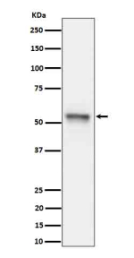 Western blot analysis of Phospho-Tau (S199) expression in mouse hippocampus cell lysate using Phospho-Tau (Ser199) antibody. The expected molecular weight of phosphorylated Tau (Ser198) is approximately 45-70 kDa, corresponding to the major Tau isoforms, and lower molecular weight bands around ~35 kDa may represent truncated Tau fragments commonly observed in brain tissue.