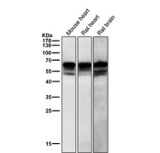 All lanes use the antibody at 1:3K dilution for 1 hour at room temperature. Expected size for c-Src (phospho-Tyr529) ~60 kDa. Observed (possible) doublet at ~55 kDa and ~60 kDa likely reflects full-length and slightly modified/truncated phosphorylated forms of c-Src, consistent with literature indicating Src family kinases migrate in the 55-62 kDa range.