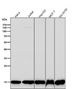 All lanes use the antibody at 1:1K dilution for 1 hour at room temperature.