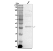 Western blot analysis of LAT using anti-LAT antibody. Lane 1: human HEL whole cell lysates. After electrophoresis, proteins were transferred to a nitrocellulose membrane at 150 mA for 50-90 minutes. Blocked the membrane with 5% non-fat milk/TBS for 1.5 hour at RT. The membrane was incubated with rabbit anti-LAT antibody at 0.5 ug/ml overnight at 4oC, then washed with TBS-0.1%Tween 3 times with 5 minutes each and probed with a goat anti-rabbit IgG-HRP secondary antibody at a dilution of 1:5000 for 1.5 hour at RT. The signal was developed using enhanced chemiluminescent. Expected molecular weight: 36-38 kDa.