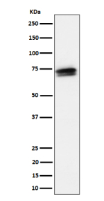 Western blot analysis of SSX2IP expression in HeLa cell lysate using SSX2IP antibody. The expected band size for SSX2IP is at 71 kDa. The protein is observed as multiple species with apparent molecular weights of 70-90 kDa, corresponding to differentially phosphorylated isoforms.