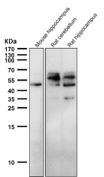 All lanes use the Phospho-Tau (Ser198) antibody at 1:2K dilution for 1 hour at room temperature. The expected molecular weight of phosphorylated Tau (Ser198) is approximately 45-70 kDa, corresponding to the major Tau isoforms, and lower molecular weight bands around ~35 kDa may represent truncated Tau fragments commonly observed in brain tissue.