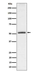 Western blot analysis of Phospho-Tau (S198) expression in mouse hippocampus cell lysate. The expected molecular weight of phosphorylated Tau (Ser198) is approximately 45-70 kDa, corresponding to the major Tau isoforms, and lower molecular weight bands around ~35 kDa may represent truncated Tau fragments commonly observed in brain tissue.