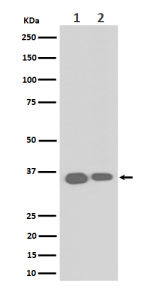 Western blot analysis of ELOVL5 expression in (1) human HeLa cell lysate; (2) mouse RAW264.7 cell lysate. Predicted molecular weight ~35 kDa and ~38 kDa (two isoforms).