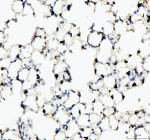 IHC analysis of Lysozyme using anti-Lysozyme antibody. Lysozyme was detected in a paraffin-embedded section of mouse lung tissue. Heat mediated antigen retrieval was performed in EDTA buffer (pH 8.0, epitope retrieval solution). The tissue section was blocked with 10% goat serum. The tissue section was then incubated with 2 ug/ml rabbit anti-Lysozyme antibody overnight at 4oC. Peroxidase Conjugated Goat Anti-rabbit IgG was used as secondary antibody and incubated for 30 minutes at 37oC. The tissue section was developed using an HRP secondary and DAB substrate.
