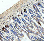 IHC analysis of Lysozyme using anti-Lysozyme antibody. Lysozyme was detected in a paraffin-embedded section of rat colon tissue. Heat mediated antigen retrieval was performed in EDTA buffer (pH 8.0, epitope retrieval solution). The tissue section was blocked with 10% goat serum. The tissue section was then incubated with 2 ug/ml rabbit anti-Lysozyme antibody overnight at 4oC. Peroxidase Conjugated Goat Anti-rabbit IgG was used as secondary antibody and incubated for 30 minutes at 37oC. The tissue section was developed using an HRP secondary and DAB substrate.