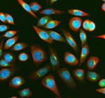 IF analysis of MSRA using anti-MSRA antibody (green) and anti-Beta Tubulin antibody (red). MSRA was detected in an immunocytochemical section of SIHA cells. Enzyme antigen retrieval was performed using IHC enzyme antigen retrieval reagent for 15 mins. The cells were blocked with 10% goat serum. And then incubated with 5 ug/ml rabbit anti-MSRA antibody and mouse anti-Beta Tubulin antibody overnight at 4oC. DyLight 488 Conjugated Goat Anti-Rabbit IgG and Cy3 Conjugated Goat Anti-Mouse IgG were used as secondary antibody at 1:500 dilution and incubated for 30 minutes at 37oC. The section was counterstained with DAPI (blue). Visualize using a fluorescence microscope and filter sets appropriate for the label used.