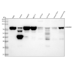 Western blot analysis of HNRNPM using anti-HNRNPM antibody. Lane 1: human Hela whole cell lysates, Lane 2: human Jurkat whole cell lysates, Lane 3: human HepG2 whole cell lysates, Lane 4: human MCF-7 whole cell lysates, Lane 5: rat liver tissue lysates, Lane 6: rat lung tissue lysates, Lane 7: mouse liver tissue lysates, Lane 8: mouse lung tissue lysates. After electrophoresis, proteins were transferred to a nitrocellulose membrane at 150 mA for 50-90 minutes. Blocked the membrane with 5% non-fat milk/TBS for 1.5 hour at RT. The membrane was incubated with rabbit anti-HNRNPM antibody at 1:500 overnight at 4oC, then washed with TBS-0.1%Tween 3 times with 5 minutes each and probed with a goat anti-rabbit IgG-HRP secondary antibody at a dilution of 1:5000 for 1.5 hour at RT. The signal was developed using enhanced chemiluminescent. The expected band size for HNRNPM is at 76 kDa. The protein is often observed as a doublet or triplet, corresponding to co-expression of splice variants and phosphorylation states.
