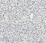 IHC analysis of HNRNPM using anti-HNRNPM antibody. HNRNPM was detected in a paraffin-embedded section of mouse liver tissue. Heat mediated antigen retrieval was performed in EDTA buffer (pH 8.0, epitope retrieval solution). The tissue section was blocked with 10% goat serum. The tissue section was then incubated with 1:50 rabbit anti-HNRNPM antibody overnight at 4oC. Peroxidase Conjugated Goat Anti-rabbit IgG was used as secondary antibody and incubated for 30 minutes at 37oC. The tissue section was developed using an HRP secondary and DAB substrate.