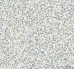 IHC analysis of HNRNPM using anti-HNRNPM antibody. HNRNPM was detected in a paraffin-embedded section of rat liver tissue. Heat mediated antigen retrieval was performed in EDTA buffer (pH 8.0, epitope retrieval solution). The tissue section was blocked with 10% goat serum. The tissue section was then incubated with 1:50 rabbit anti-HNRNPM antibody overnight at 4oC. Peroxidase Conjugated Goat Anti-rabbit IgG was used as secondary antibody and incubated for 30 minutes at 37oC. The tissue section was developed using an HRP secondary and DAB substrate.