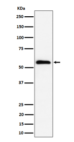 Western blot analysis of PNK / PNKP expression in human HeLa cell lysate using PNKP antibody. Predicted molecular weight ~57 kDa.