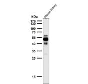 All lanes use the Phospho-Tau (Ser404) antibody at 1:2K dilution for 1 hour at room temperature. The expected molecular weight of phosphorylated Tau (Ser198) is approximately 45-70 kDa, corresponding to the major Tau isoforms, and lower molecular weight bands around ~35 kDa may represent truncated Tau fragments commonly observed in brain tissue.
