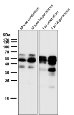 All lanes use the Phospho-Tau (Ser404) antibody at 1:2K dilution for 1 hour at room temperature. The expected molecular weight of phosphorylated Tau (Ser198) is approximately 45-70 kDa, corresponding to the major Tau isoforms, and lower molecular weight bands around ~35 kDa may represent truncated Tau fragments commonly observed in brain tissue.
