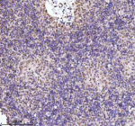 IHC analysis of RBBP8 using anti-RBBP8 antibody. RBBP8 was detected in a paraffin-embedded section of human spleen tissue. Heat mediated antigen retrieval was performed in EDTA buffer (pH 8.0, epitope retrieval solution). The tissue section was blocked with 10% goat serum. The tissue section was then incubated with 2 ug/ml rabbit anti-RBBP8 antibody overnight at 4oC. Peroxidase Conjugated Goat Anti-rabbit IgG was used as secondary antibody and incubated for 30 minutes at 37oC. The tissue section was developed using an HRP secondary and DAB substrate.
