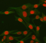 IF analysis of RBBP8 using anti-RBBP8 antibody (red) and anti-Beta Tubulin antibody (green). RBBP8 was detected in immunocytochemical section of HELA cell. Enzyme antigen retrieval was performed using IHC enzyme antigen retrieval reagent for 15 mins. The cells were blocked with 10% goat serum. And then incubated with 5 ug/ml rabbit anti-RBBP8 antibody and mouse anti-Beta Tubulin antibody overnight at 4oC. Cy3 Conjugated Goat Anti-Rabbit IgG and FITC Conjugated Goat Anti-Mouse IgG were used as secondary antibody at 1:500 dilution and incubated for 30 minutes at 37oC. Visualize using a fluorescence microscope and filter sets appropriate for the label used.